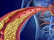 Старое немецкое средство поможет очистить и укрепить сосуды