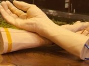 В Google работают над браслетом для диагностики заболеваний (Видео)