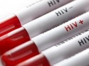 Система "ВИЧ-инфекция в Украине" заработает в тюрьмах