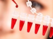 Анализ крови заменят анализом пота с помощью электронного пластыря