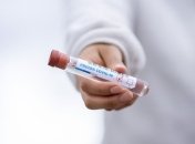 В Україні зареєстрували 49 607 випадків коронавірусу