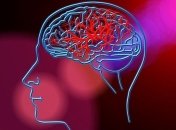 Женский инсульт: факторы, которые влияют только на женщин