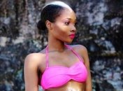 Эту девушку обзывали скунсом из-за белой полосы в волосах, но она выросла и стала моделью (Фото)