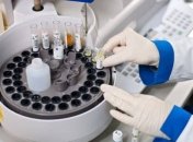 У Києві зменшилася кількість нових випадків коронавірусу за добу