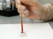 В Украине создают Национальный реестр доноров крови 