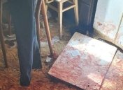 В России мужчина вышел из запоя, избил жену и отрезал себе пенис, а потом стоял с ним на улице (фото и видео)