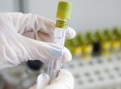 У США кількість інфікованих коронавірусом зросла до 10 тисяч