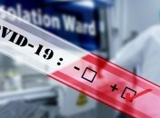 На Житомирщині у двох лікарів підтвердили коронавірус