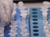 В Одесской области всплеск заболеваемости COVID-19: за сутки 95 случаев 