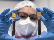 У Києві 25 нових підтверджених випадків коронавірусу