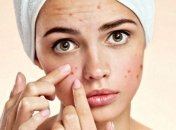 Диета от прыщей: продукты для здоровья кожи