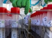 Лечение COVID-19: Минздрав внес еще один препарат в протокол