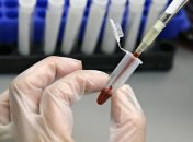 Препарат генной терапии станет самым дорогим лекарством в мире