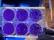 Медики назвали терміни одужання від коронавірусу