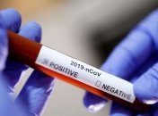 Кабмин утвердил план противодействия коронавирусу