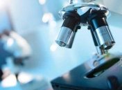 В Україні з'являться тест-системи для прискорення діагностики коронавіруса