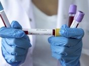 Заболеваемость COVID-19 резко выросла: в Украине вновь почти 900 случаев