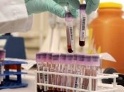 Анализ крови выявит аллергию на протез