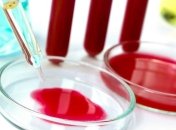 Медики научились определять рак по анализу крови