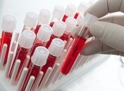 Онкологию можно диагностировать по анализу крови 