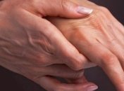 Лечение с экземы с помощью народных средств