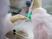 Украинцам подсказали, как бесплатно сдать тест на антитела к коронавирусу