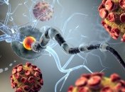 Медики назвали первые симптомы рассеянного склероза