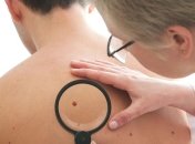 Что значат родинки на теле 