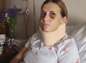 Нападение на журналистку в поезде "Киев-Мариуполь" у подозреваемого обнаружилась онкология