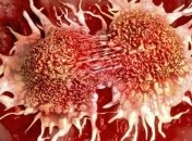 Ученые смогли проследить за "рождением" раковой клетки