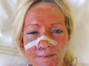 Постраждала Лілія