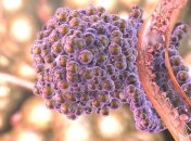 Ученые узнали причину появления метастазов еще до появления раковой опухоли