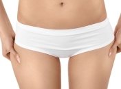 Почему образуется целлюлит?