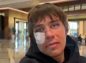 Прокинувся – і отримав у око: з’явилося відео з побитим російським футболістом