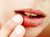 Методы лечения герпеса 