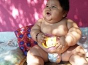 10-месячная девочка весит как пятилетний ребенок