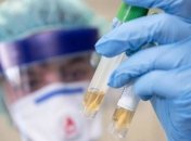 COVID-19 на Тернопольщине: 467 случаев заболевания, из них 7 летальных