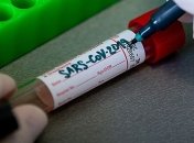 COVID-19 в Житомирской области: Медики зарегистрировали два новых случая