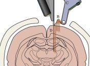 В планах создание "швейной машины", которая будет вживлять электроды в мозг