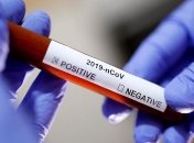 В Николаевской области за сутки - 42 новых случая COVID-19