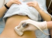 Мнение врача: 4 вопроса про УЗИ во время беременности