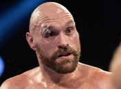 "Левый джеб прямо в нос": Фьюри заявил, каким ударом отправит Уайлдера в нокаут