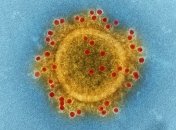 Определить коронавирус за 45 минут: В США утвердили новые экспресс-тесты