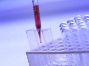 В Україні збільшується кількість хворих на коронавірус