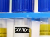 "Свадьба пела и плясала": во Львове - новая вспышка COVID-19