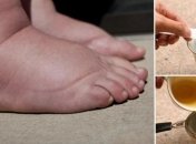 Этот чай является лучшим средством для снятия отечности в ногах 