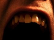 Выпадение зубов влияет на память