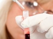 Обнаружен новый вирус, который передается через кровь 