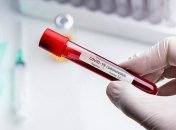 Эпидемия коронавируса: в Винницкой области зарегистрировано 766 инфицированных