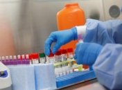 Выход из самоизоляции: в Минздраве рассказали, кому не нужно делать ПЦР-тест